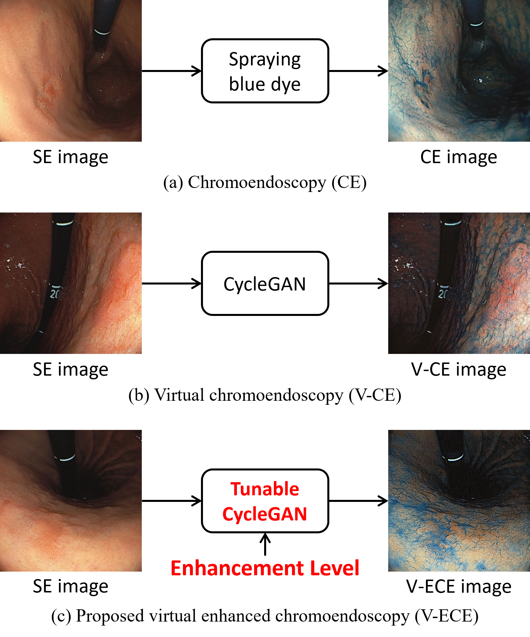 Comparison of chromoendoscopy techniques